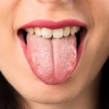 Qi Deficiency, Blood Deficiency